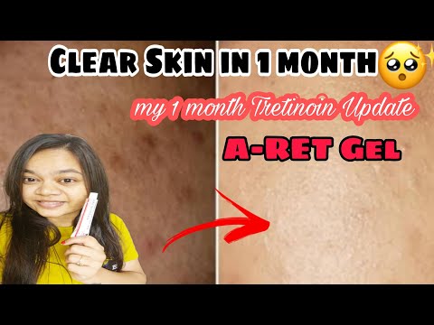 A Ret 0.1% Gel, 0.05%