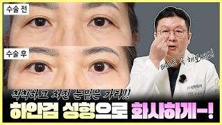 눈 밑 처짐 걱정 끝! 하안검 성형의 모든 것 | 제이티성형외과 김진성 원장