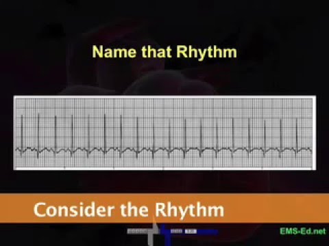 Intro EKG Interpretation Part 2