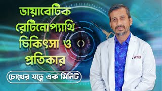 রেটিনোপ্যাথির চিকিৎসা | TREATMENT OF RETINOPATHY | Dr. Muhammad Moniruzzaman | Retina Specialist