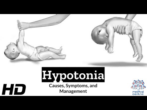 Hypotonia Explained: What You Need to Know