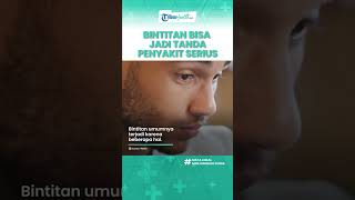 Sering Muncul Bintitan di Kelopak Mata Bisa Jadi Tanda Penyakit Serius, Termasuk Diabetes & Kanker