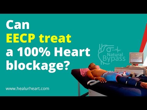 Can EECP treat a 100% blockage?
