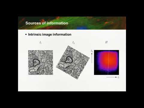 Basics of Image Processing: Image Registration