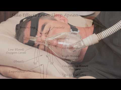 Benefits of CPAP Therapy a