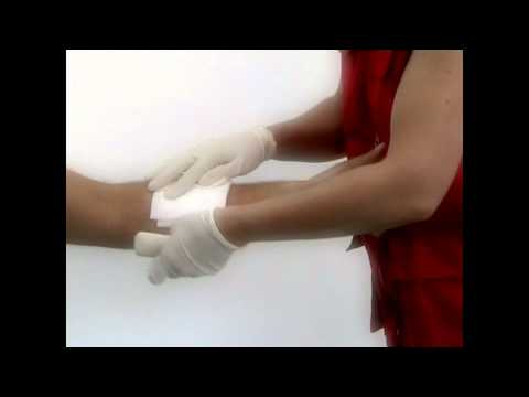 Hemorragias - primeiros socorros