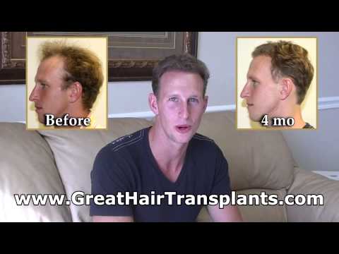 Cameron's 4mo Testimonial