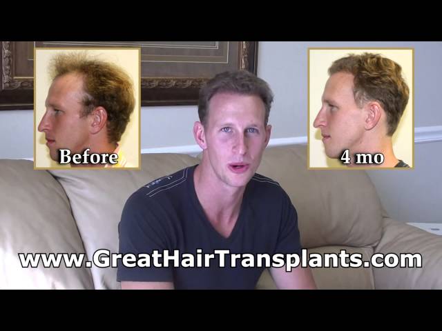Cameron's 4mo Testimonial