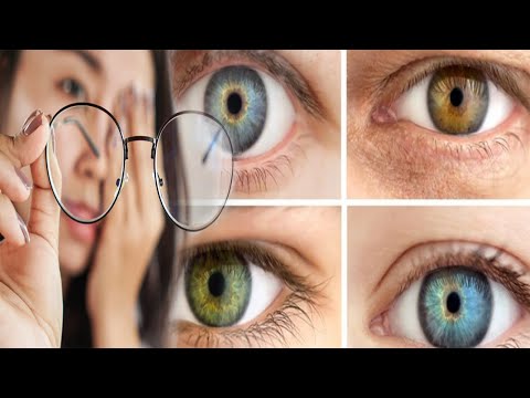 Mos i neglizhoni. Ja çfarë tregon ngjyra dhe forma e syve për shëndetin