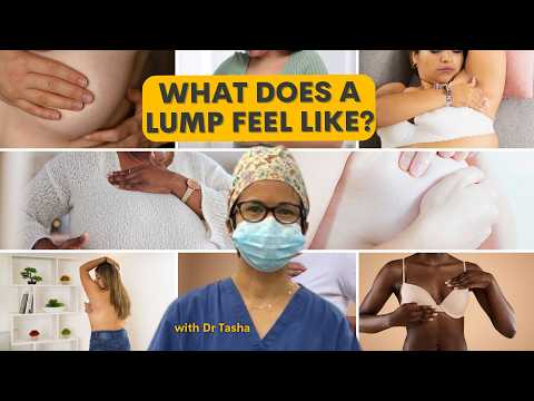 What does a breast cancer lump feel like, and how to examine your breasts, with Dr Tasha