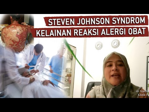 Steven johnson syndrom || KELAINAN REAKSI ALERGI OBAT