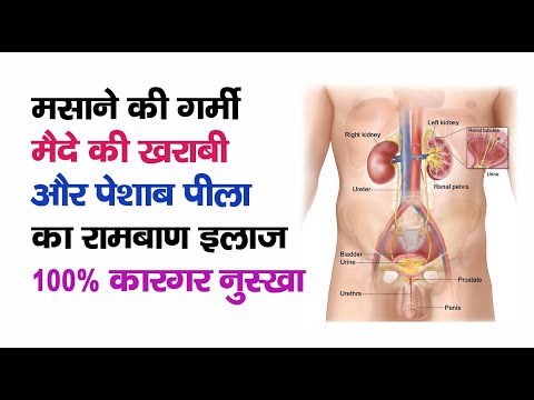 Cipzer sikanjabeen buzoori motadil