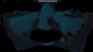 CORPORATE 09 - Acidosis (Distorted Beats Remix 1991)