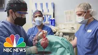 First Successful Transplant Of Pig Heart To Human Patient Performed In Maryland