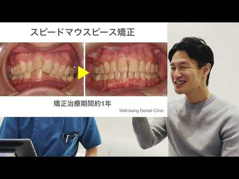 スピード矯正治療