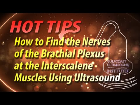 How to Find the Nerves of the Brachial Plexus at the Interscalene Muscles Using Ultrasound.