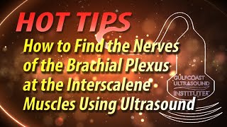 How to Find the Nerves of the Brachial Plexus at the Interscalene Muscles Using Ultrasound.