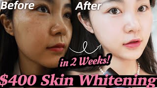 REAL EXPERIENCE: k-pop idols whitening treatment! Unexpected results! 🤯 | Lyn Beauty