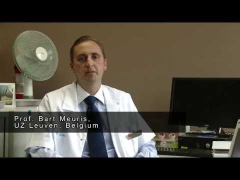 Aortic valve replacement with Perceval S