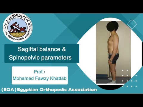 Sagittal balance & Spinopelvic parameters Prof Mohamed Fawzy Khattab