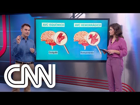 O que é e quais são os sintomas do AVC? - Correspondente Médico