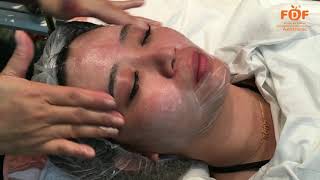 Download lagu FDF Lightening & Brightening Treatment mp3