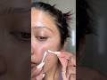 Let’s peel this mega pimple patch and do some extraction #acne #pimplepatch #acnepatch #acneprone