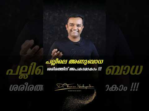 🦷 പല്ലിലെ അണുബാധ ശരീരത്തിന് അപകടമാകാം! #palludoctor #dentalclinic #smiledesigndental #dentalvideos