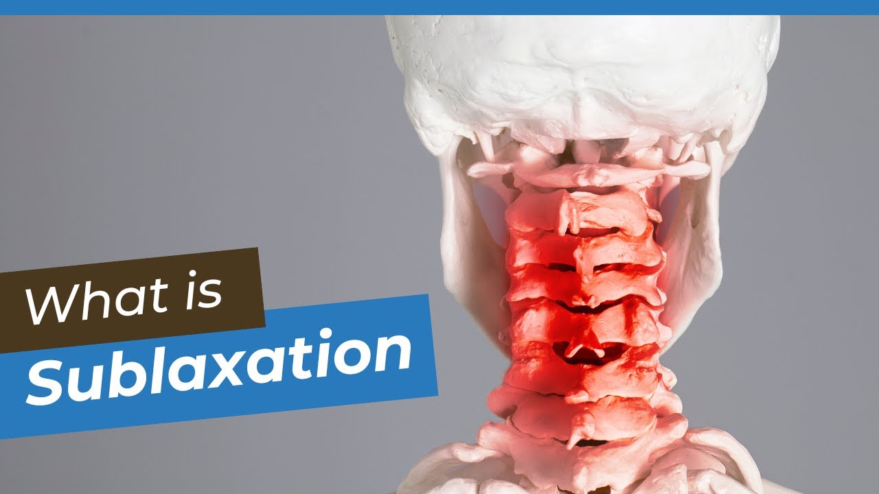 What Is a Subluxation? Correcting Spinal Misalignments for Nerve Health