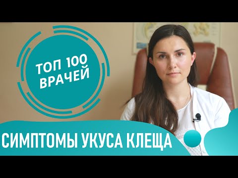 Признаки и симптомы укуса клеща у человека. Как выглядит место укуса клеща (фото 1-7)