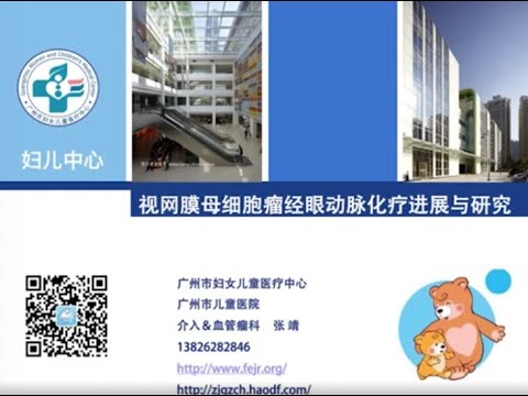 Retinoblastoma: Dos and Donts of Selective Intra-Arterial Chemotherapy Drs Drummond Xia & Jung Zhang