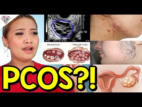 Sa pamamagitan Bormental mawalan ng timbang Slimming itim na karbon