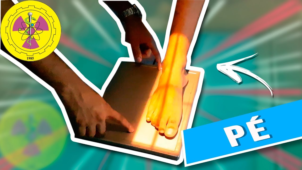 POSITIONING: ROUTINE FOOT