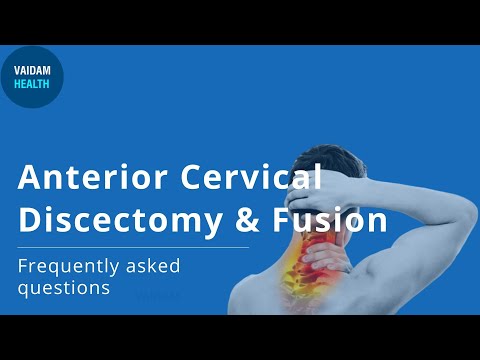 Anterior Cervical Discectomy Fusion - Frequently Asked Questions