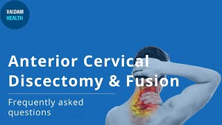 Anterior Cervical Discectomy Fusion - Frequently Asked Questions