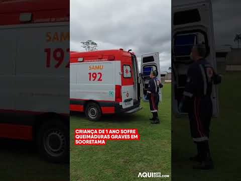 Criança de 1 ano sofre queimaduras graves em Sooretama