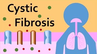 Cystic Fibrosis and the Mucociliary System