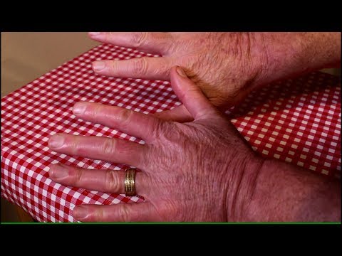 Swollen Itchy Fingers from Thoracic Outlet Syndrome