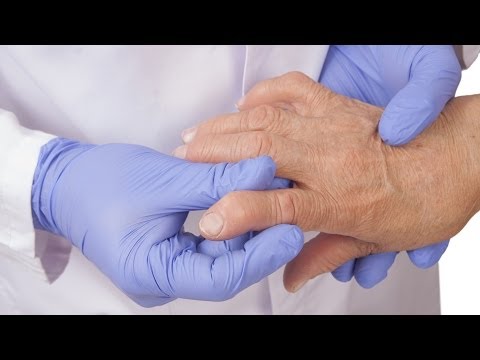 Arthrosis kezelés alternatív gyógyászat