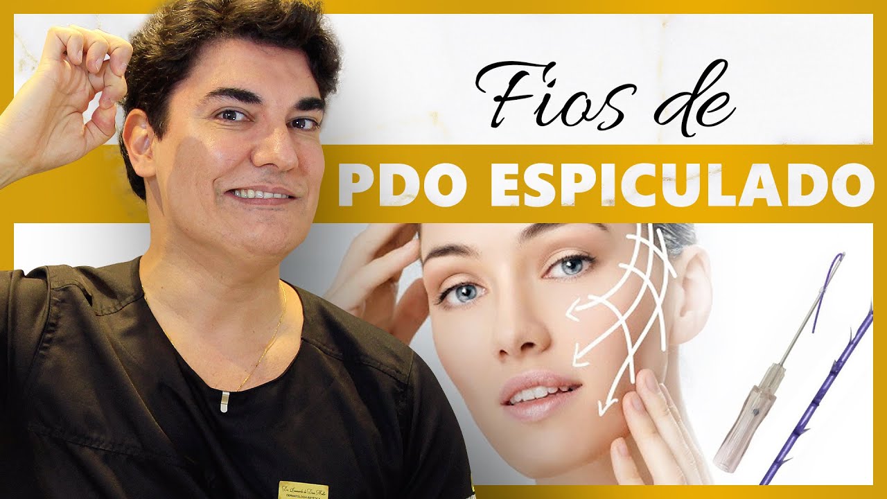 Fios de PDO Espiculado