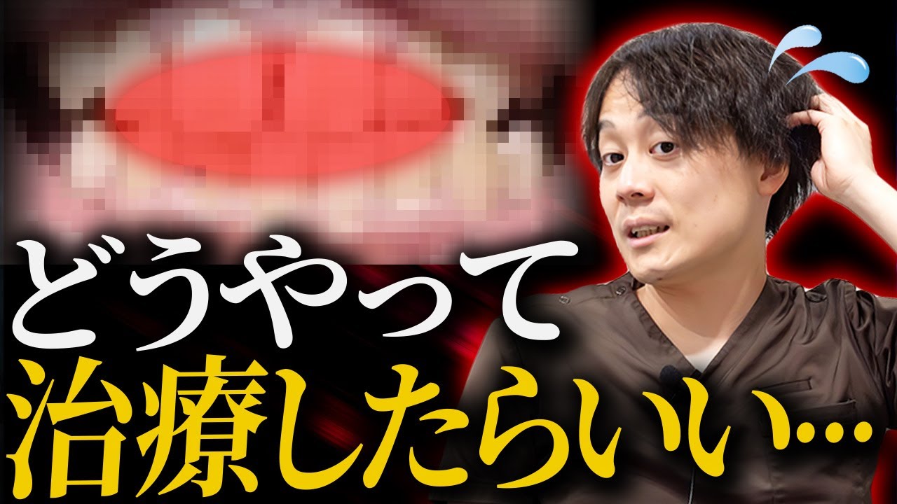 視聴者の歯並び診断したら頭を抱える事態に【歯列矯正】