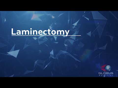 Laminectomy - Patient Animation
