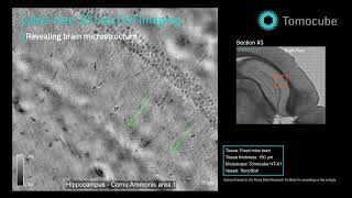 3D Holotomography of Brain Structures and Organoids | Label-Free Live Imaging (4K)