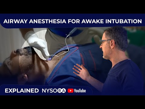 NYSORA (Airway Anesthesia)