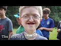 FACES: The National Craniofacial Association
