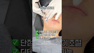 리쥬란 손주사 vs 인젝터 차이는?