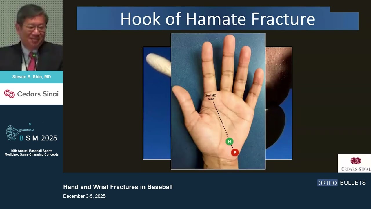 Hand and Wrist Fractures in Baseball_Steven Shin MD