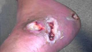 Machine head Take my scars