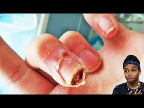 you can't click on this video...