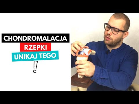 Czego unikać przy CHONDROMALACJI RZEPKI / ZMIANACH ZWYRODNIENIOWYCH STAWU KOLANOWEGO ?